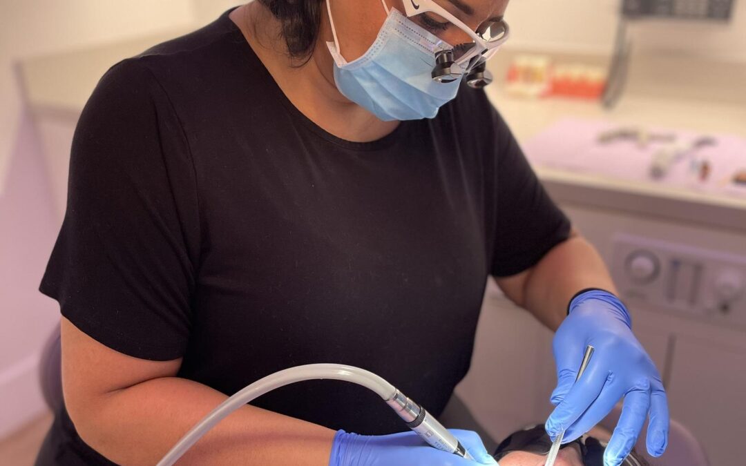 Specialized Frenectomy Services in Santa Clarita